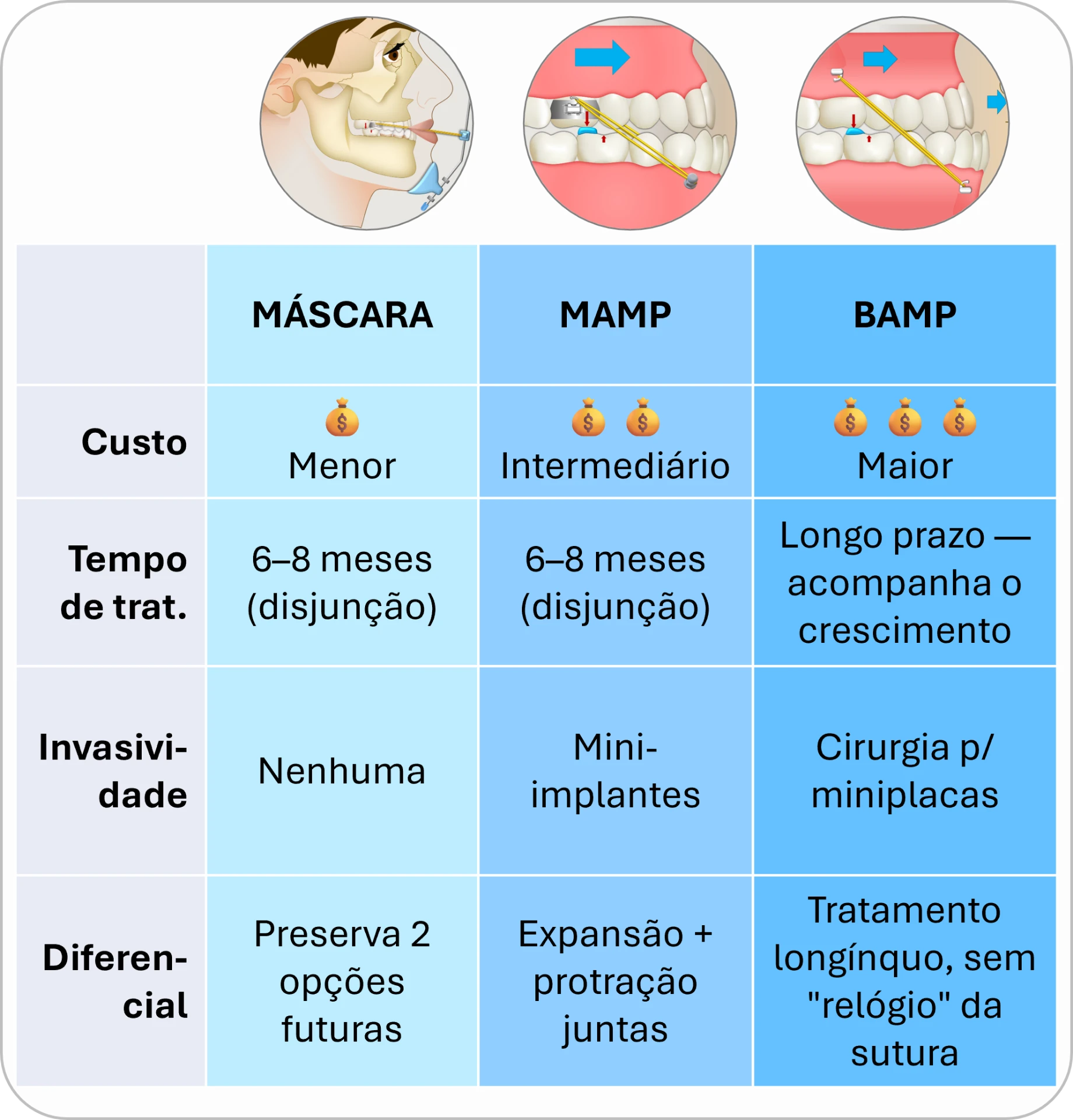 Quadro comparativo de custo, tempo de tratamento, invasividade e diferencial entre Máscara, MAMP e BAMP.