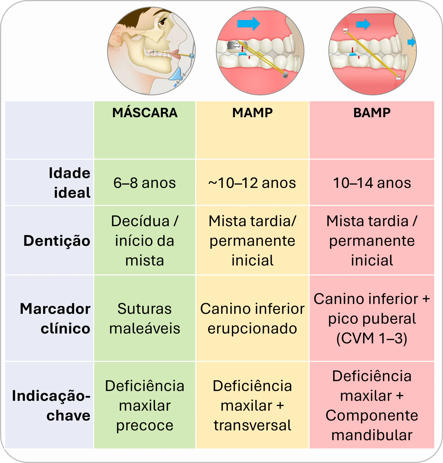 Tabela comparativa de idade ideal, dentição, marcador clínico e indicação-chave da Máscara, do MAMP e do BAMP.