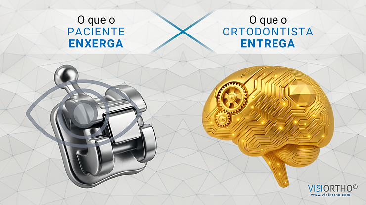 Braquete autoligado ao lado de um cérebro dourado, representando percepção do paciente e valor real do ortodontista.