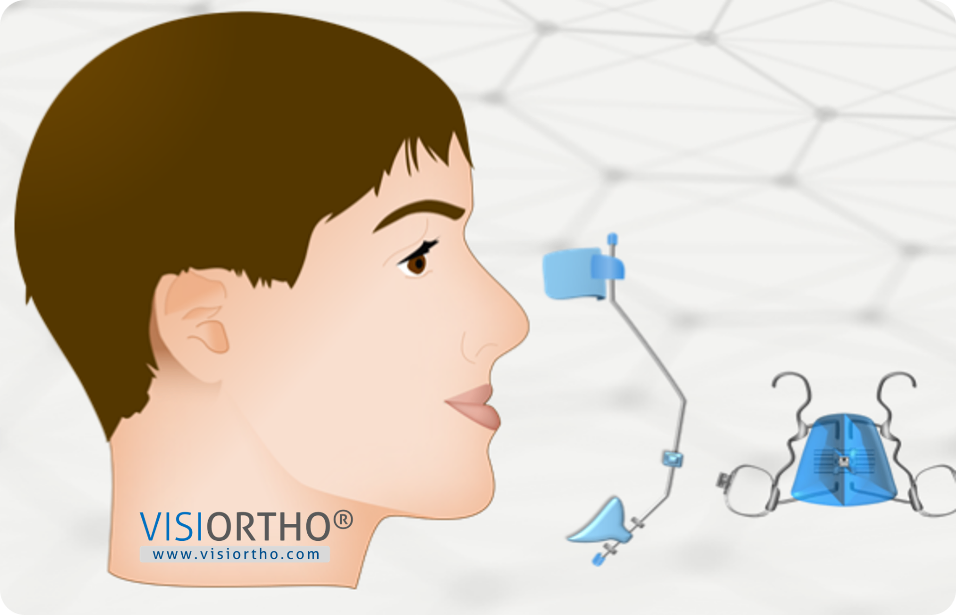 Perfil facial ao lado da máscara facial de Petit e do expansor tipo Haas.