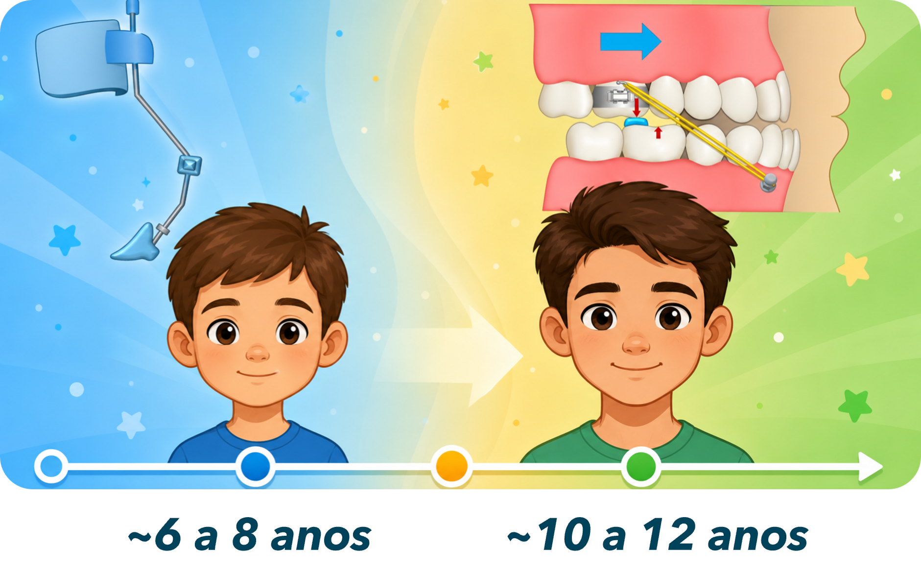 Linha do tempo comparando a janela da máscara facial (6 a 8 anos) e a janela do MAMP (10 a 12 anos).