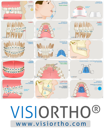 Mosaico com ilustrações do Visiortho — biblioteca de animações ortodônticas 3D.